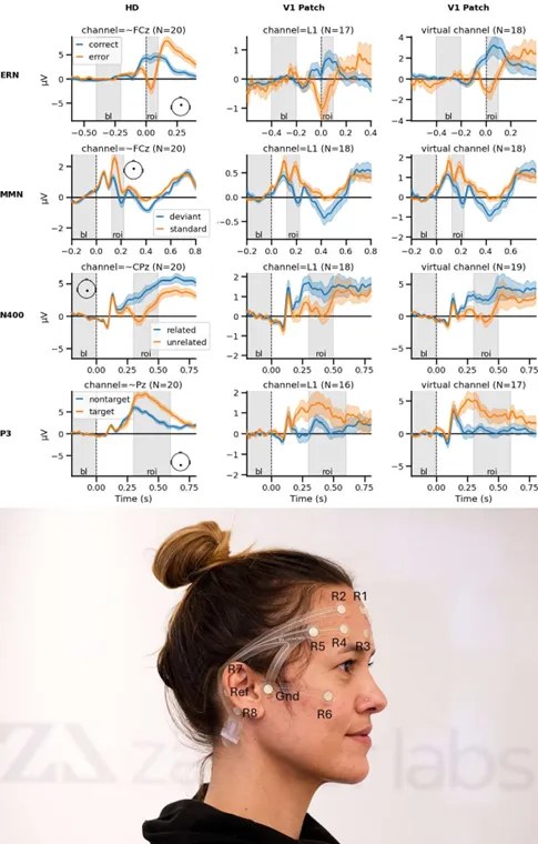 Figure 1, top: Comparison of grand-average ERPs. Left column: Taken from high-density recordings, looking at sites sugge